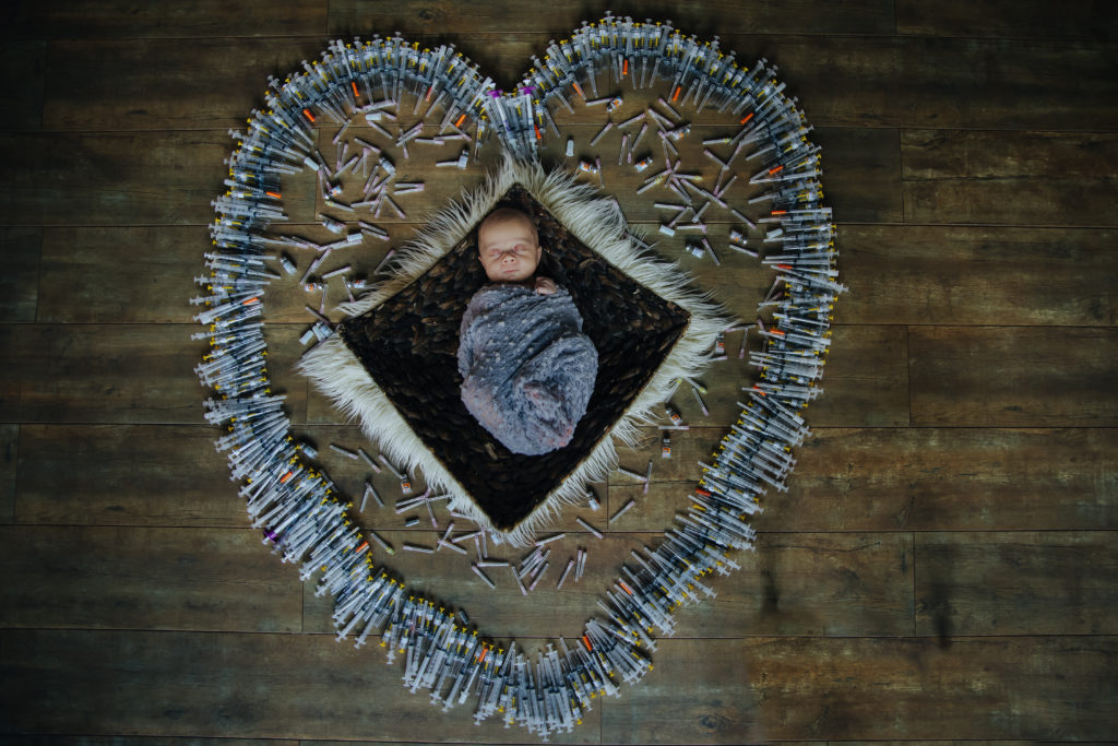 baby surrounded by IVF needles